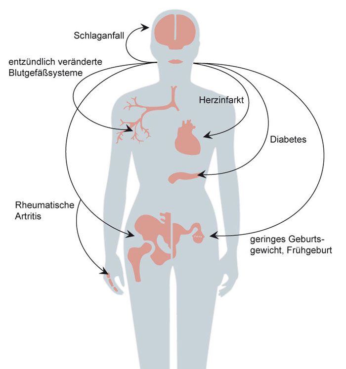 Allgemeingesundheit